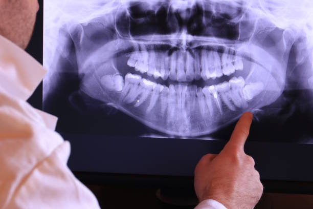 Best Weekend Emergency Dentist in Capitan, NM
