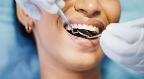 Best Emergency Dental Care for Broken or Chipped Teeth in Capitan, NM