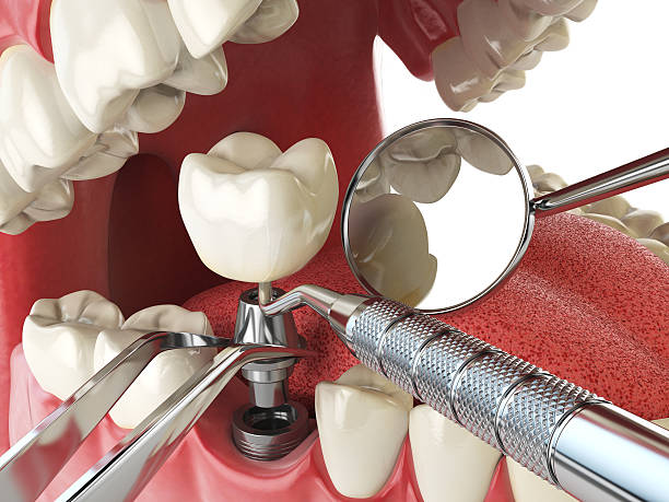 Best Pediatric Emergency Dentist in Capitan, NM